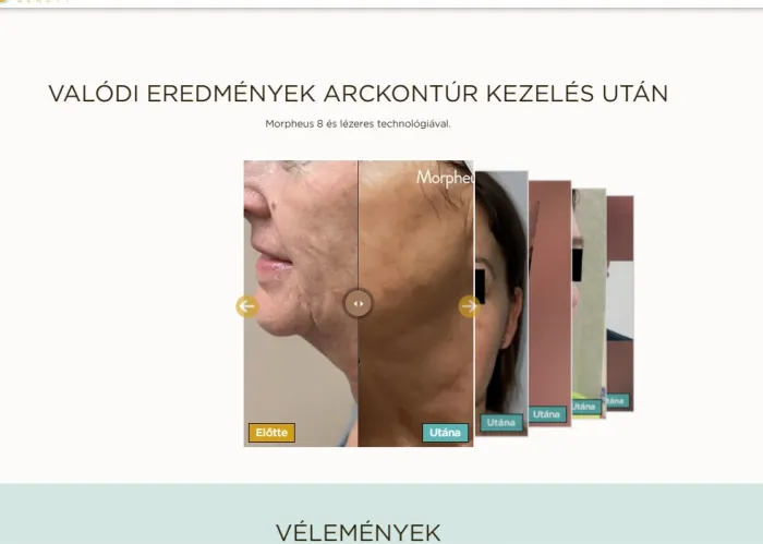 Lapozható előtte-utána blokk - WN Sales